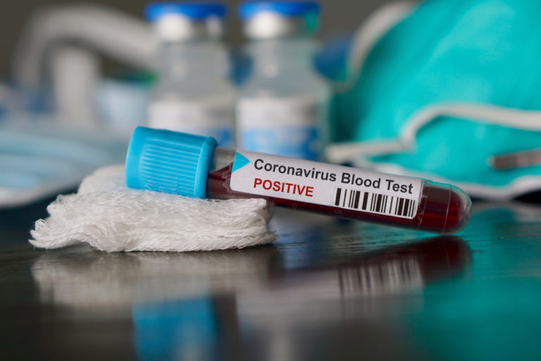 First USVI Case of New Coronavirus Confirmed Friday